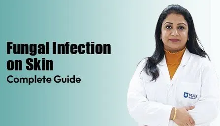 fungal-infection-on-skin-complete-guide