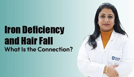 iron-deficiency-and-hair-fall